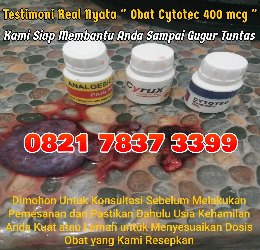 aborsi di apotik padang lawas utara 081381814581 jual obat cytotec penggugur kandungan di padang law